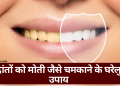 दांतों को मोती जैसे चमकाने के घरेलु उपाय |