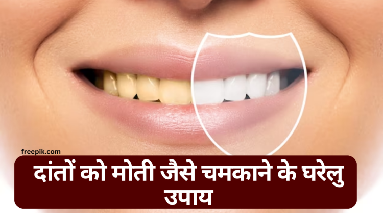 दांतों को मोती जैसे चमकाने के घरेलु उपाय |