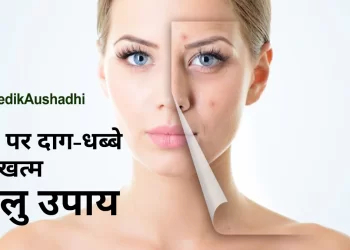 How to Glow Face Naturally :चेहरे के दाग धब्बे हटाने के घरेलु उपाय|