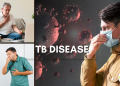 TB ke Lakshan , टीबी के लक्षण-कारण, घरेलु आयुर्वेदिक उपचार |