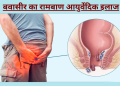 बवासीर के घरेलू उपाय