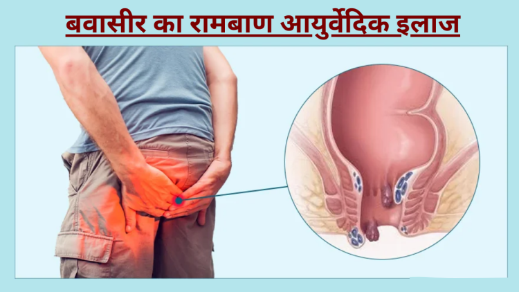 बवासीर के घरेलू उपाय
