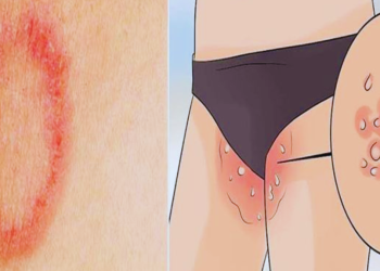 dad ki samsyaa thik karne ke gharelu upay