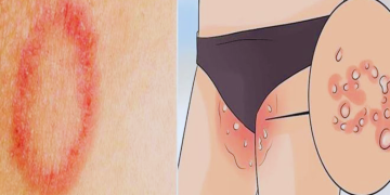 dad ki samsyaa thik karne ke gharelu upay