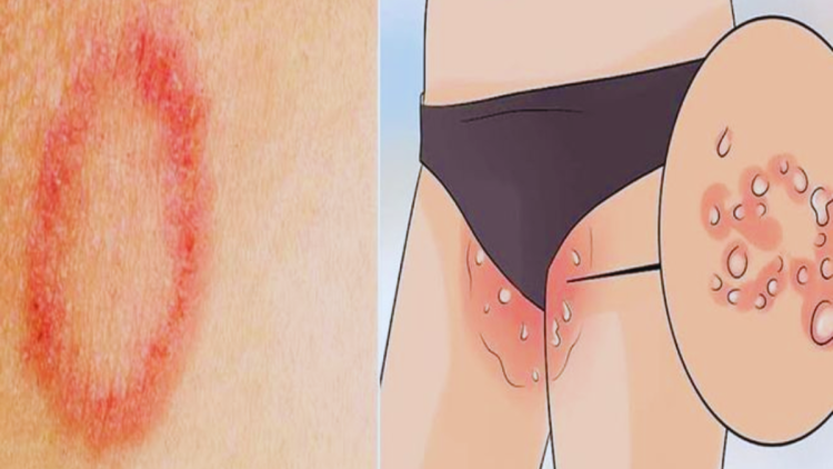 dad ki samsyaa thik karne ke gharelu upay