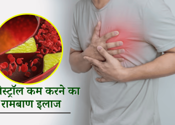 कोलेस्ट्रॉल कम करने का रामबाण इलाज |