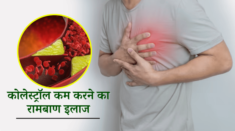 कोलेस्ट्रॉल कम करने का रामबाण इलाज |